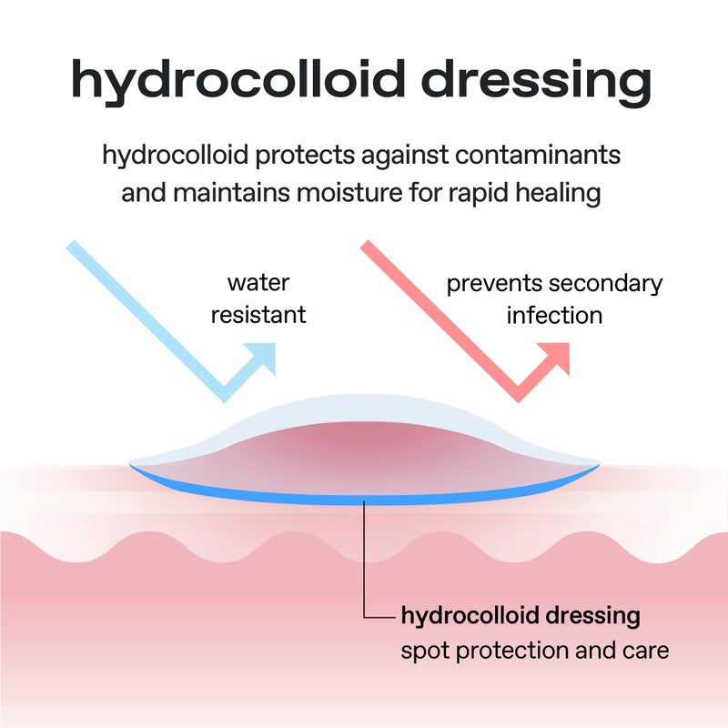 glow diamond drop blemish patch | protects blemishes from water & external contaminants | holographic hydrocolloid spot‑repair patches | niacinamide | clear invisible finish | 100 ea - Image 3